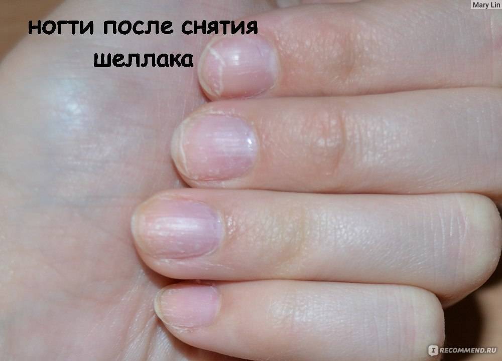 Вред гель-лака для ногтей: чем опасен для здоровья организма – безопасные для маникюра