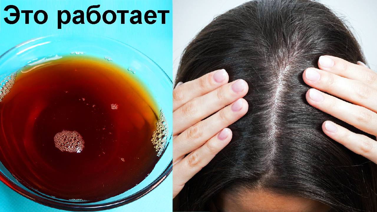 Мытьё головы содой: отзывы специалистов и эффективные рецепты, видео
