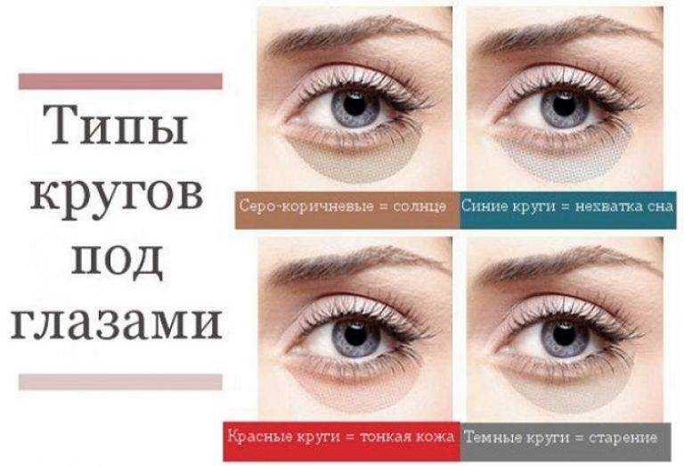 Как убрать морщины под глазами - самые действенные методы, как разгладить морщинки и избавиться от складок