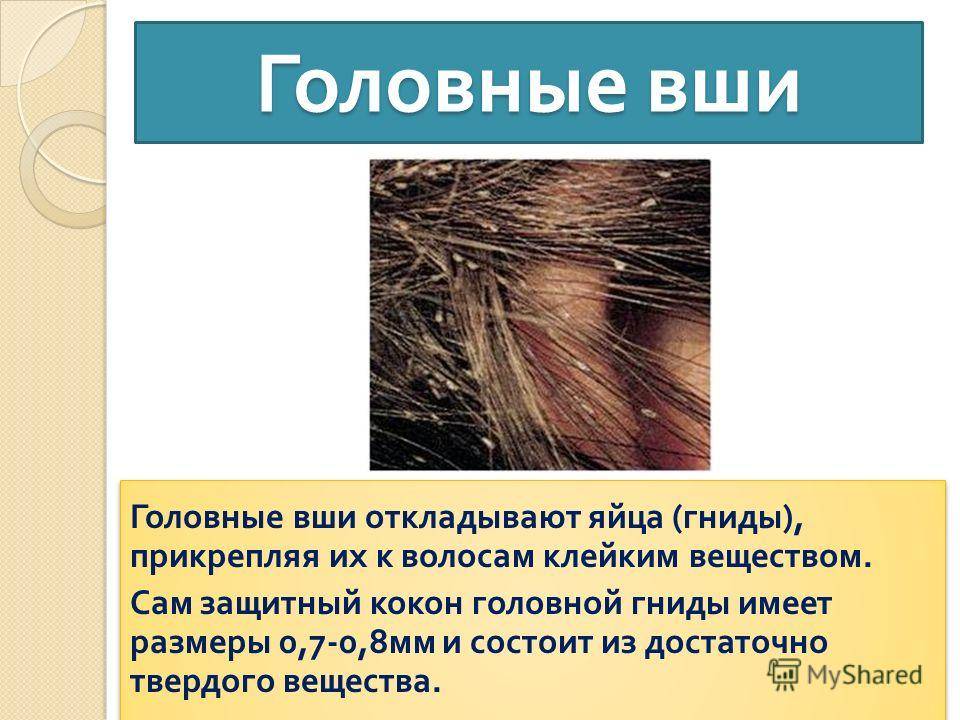 Мертвые гниды - как отличить от живых