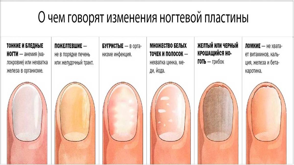 По каким причинам не растут ногти на руках и ногах у ребенка