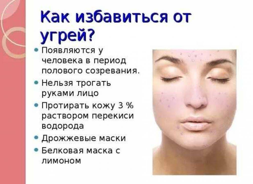 Акне: как с ними бороться, чтобы раз и навсегда