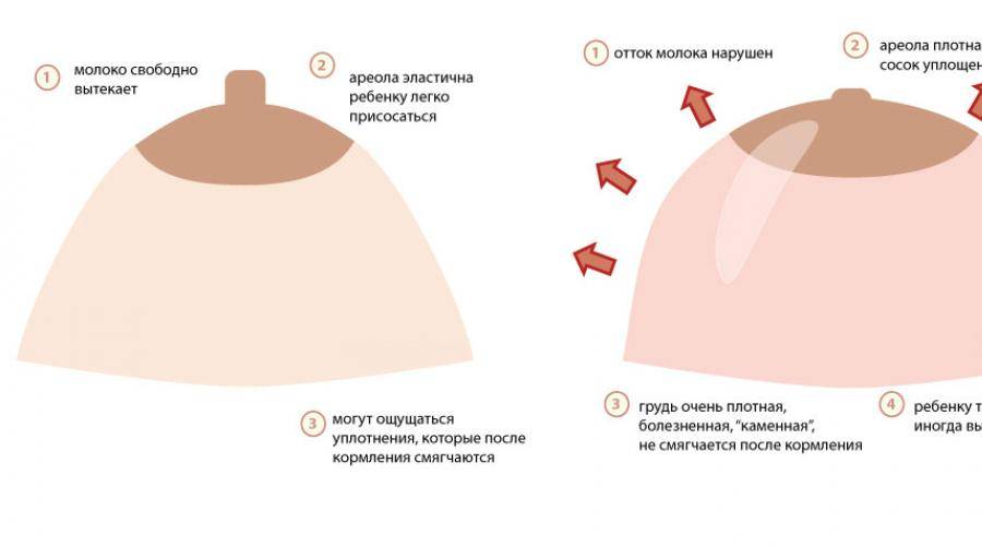 Ареал соска. Цвет сосков у беременных. Грудь при беременности. Ореолы при беременности.