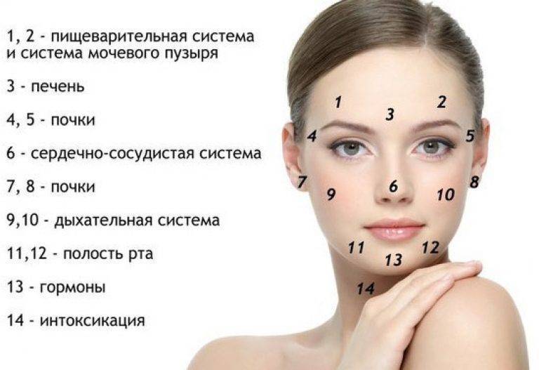 Прыщи на шее у женщин: причины и лечение на лице, из-за чего появляются гнойнички на спине, подкожные угри