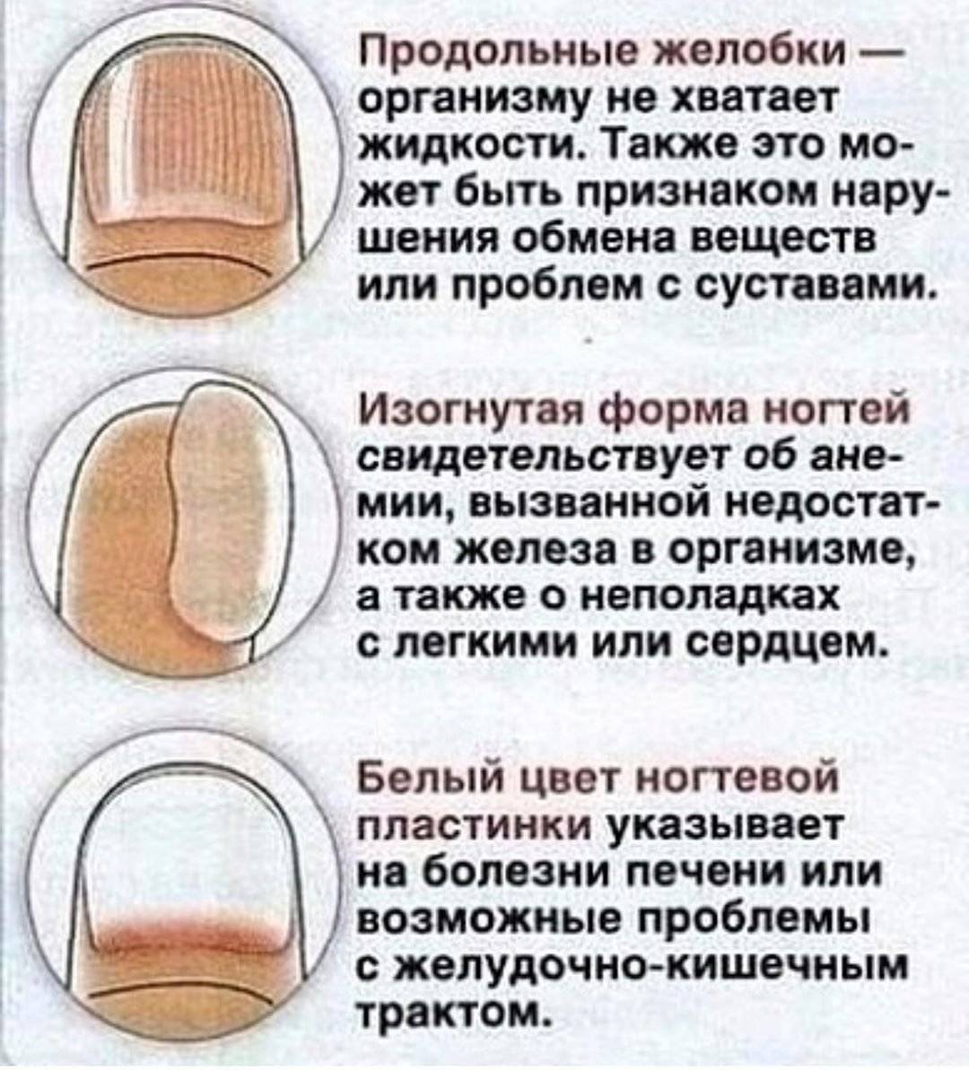 Черные полоски под ногтями рук и ног
