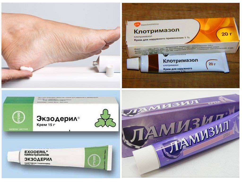 Кремы и мази от грибка на ногах