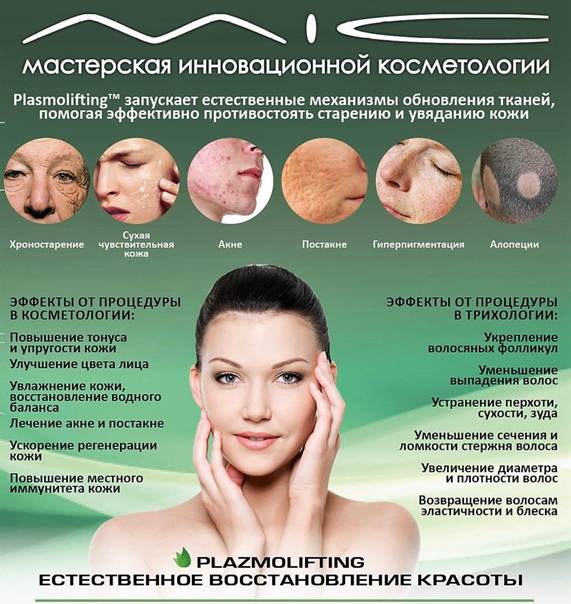 Плазмолифтинг волос: побочные эффекты и скрытые опасности