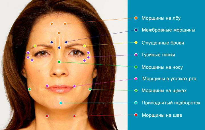Что делать, если после ботокса опустились веки и почему это может произойти