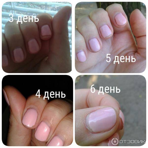 Почему отслаивается гель-лак с кончиков ногтей и скалывается