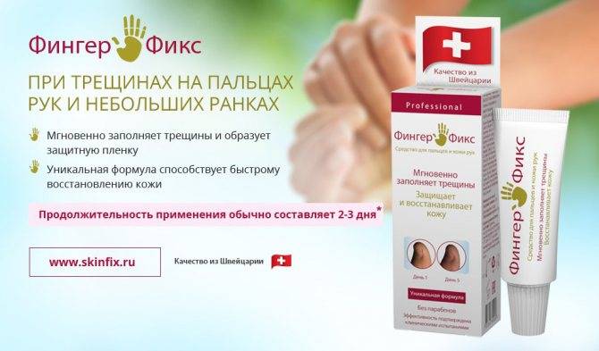 Сухая кожа на локтях — причины и методы борьбы