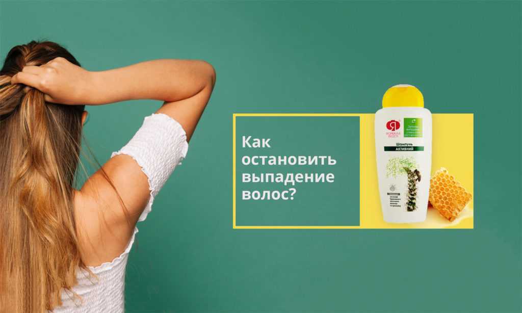 Выпадение волос - причины и лечение у мужчин