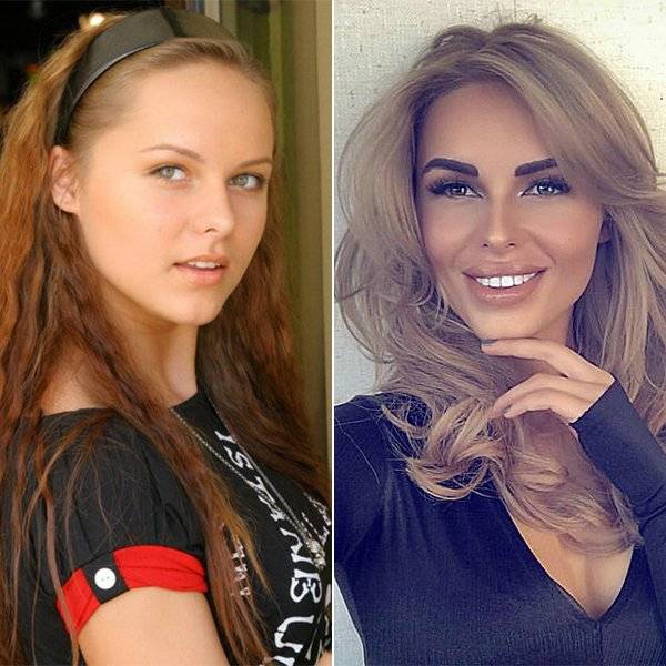 Ханна российская певица до и после пластических операций: какая она