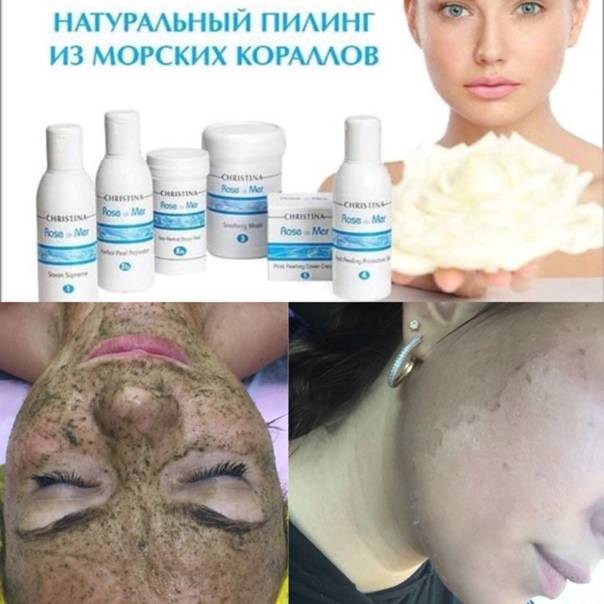 Коралловый пилинг роз де мер (christina rose de mer): преимущества, противопоказания, фото до и после