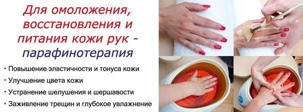Польза парафинотерапии