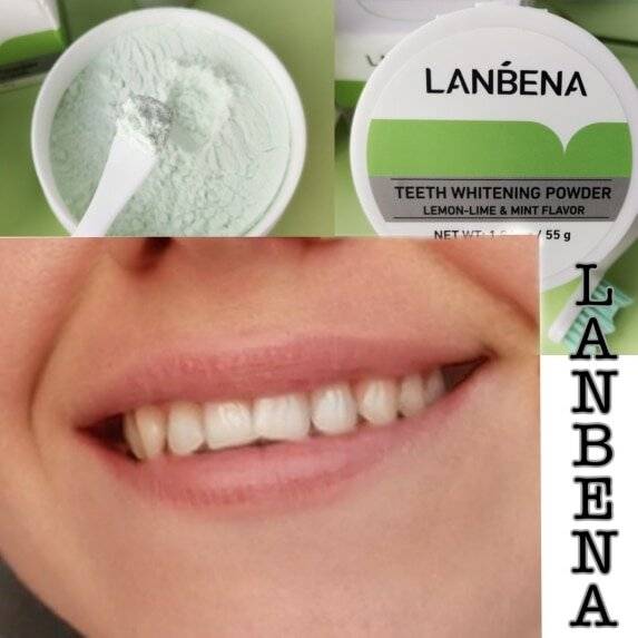 Как эффективно отбелить зубы в домашних условиях — женский журнал like