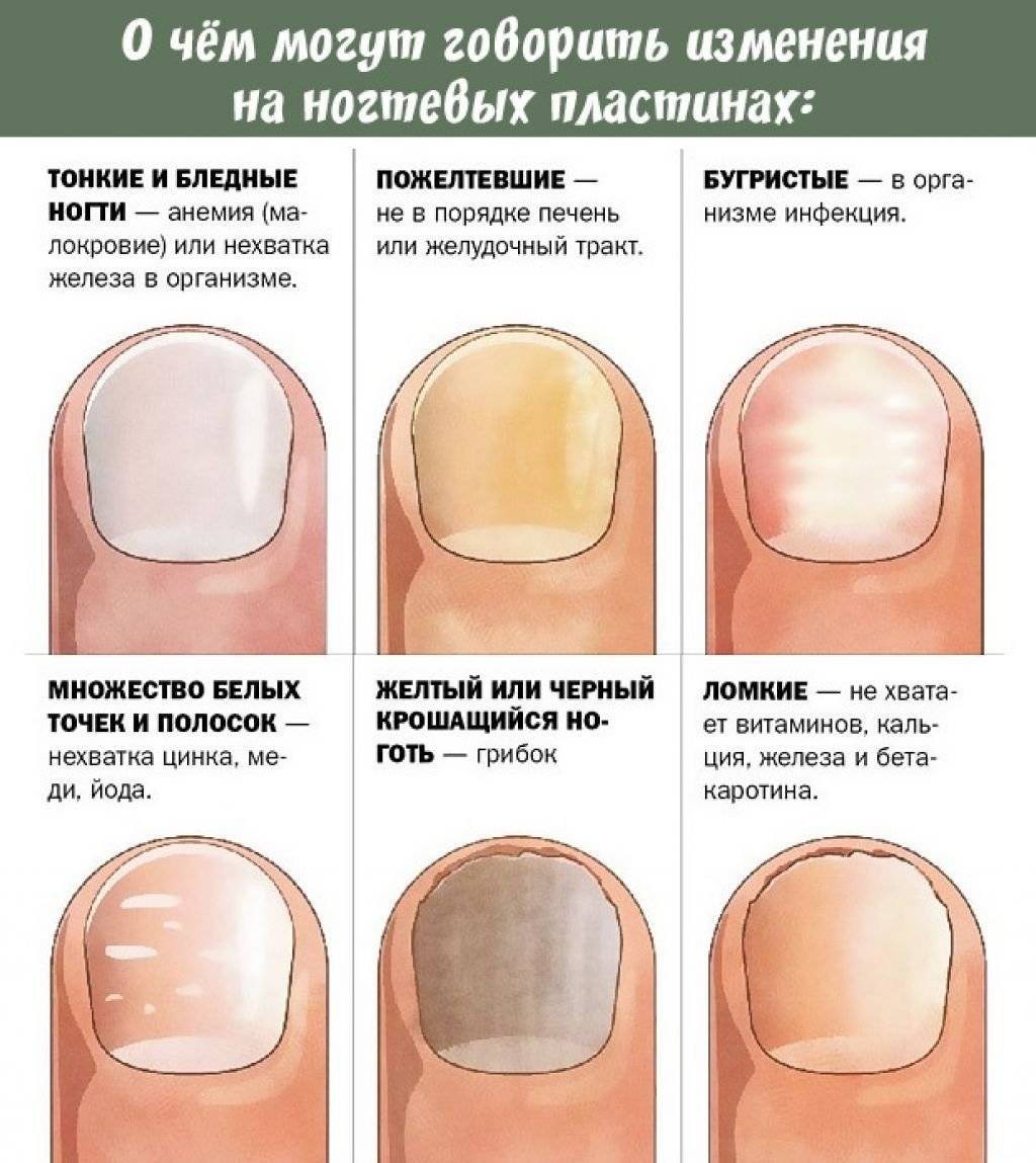 Почему не растут ногти на руках у ребенка: возможные причины