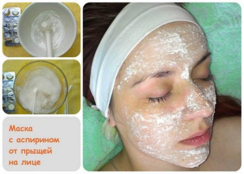 Самые эффективные маски от прыщей