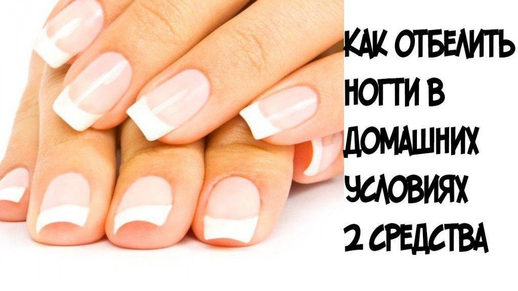 Способы отбеливания ногтей в домашних условиях