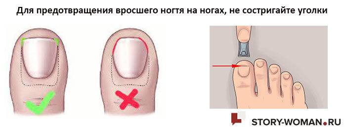 Как изменить форму ногтей в домашних условиях на руках?