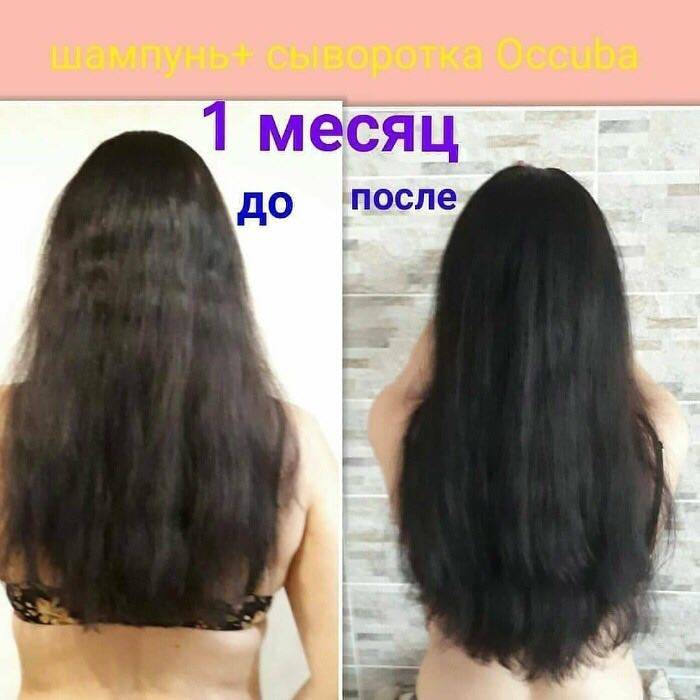Как быстро растут волосы на голове у женщин и мужчин, какова средняя скорость в месяц, за год, что влияет