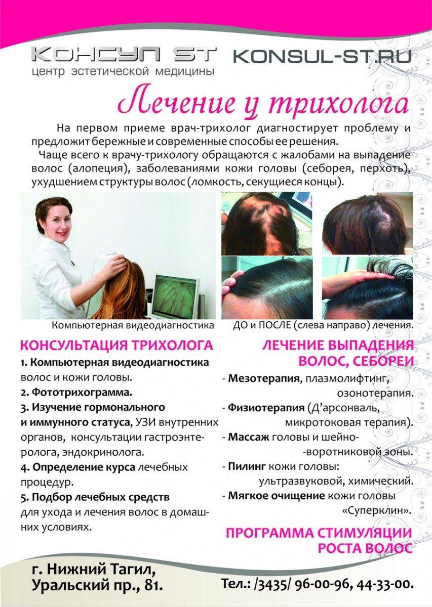 Алопеция — лечение, профилактика выпадения волос средствами alerana